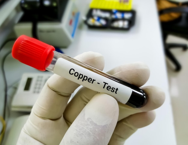 Testy penetracyjne co to oznacza w praktyce?